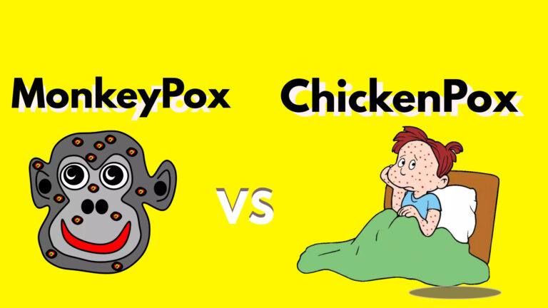 The Battle of the Pox: Monkeypox vs Chickenpox – A Comprehensive Comparison